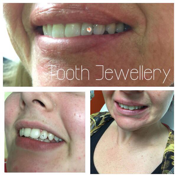 TOOTH JEWELLERY - Clinical Skin